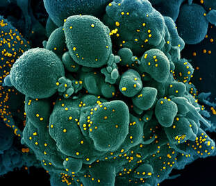 Yellow virus particles on a green cell (electron micrograph)