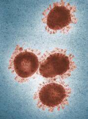 Image of dark red coronavirus particles on a blue background