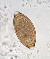 Photomicrograph of oval whipworm egg