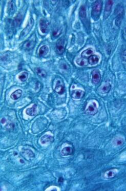 Microscope image of blue and purple oval virus particles among blue skin cells